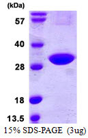 SDS-PAGE of recombinant human CINP protein under reducing conditions Coomassie blue stain