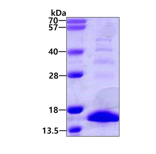 SDS-PAGE gel of recombinant mouse S100A9 protein under reducing conditions Coomassie blue stain