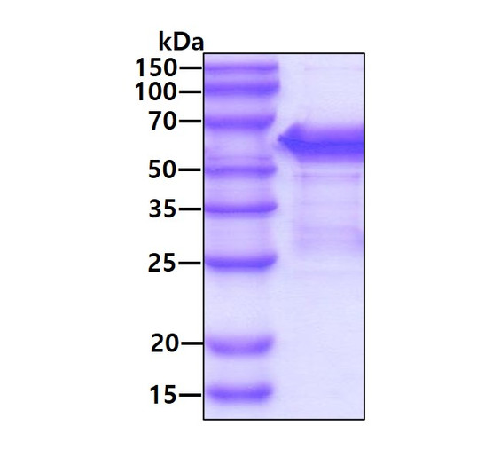 SDS-PAGE gel of recombinant human SHC1 protein 3µg under reducing conditions Coomassie blue stained