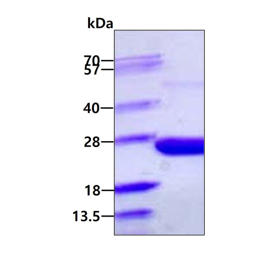 SDS-PAGE gel of recombinant E. coli PPA protein under reducing conditions Coomassie blue stain