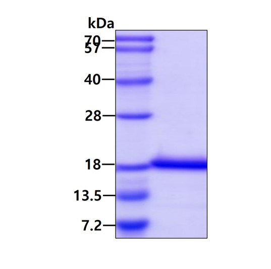 SDS-PAGE gel of recombinant human UbcH5b UBE2D2 protein under reducing conditions