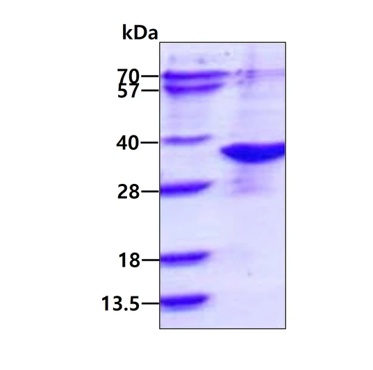 SDS-PAGE gel of recombinant human NAA10 protein under reducing conditions stained with Coomassie blue