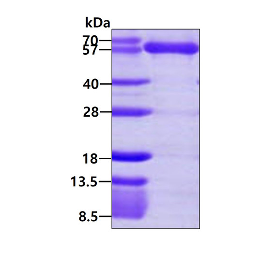 SDS-PAGE gel of recombinant human KARS protein 3 μg stained with Coomassie blue
