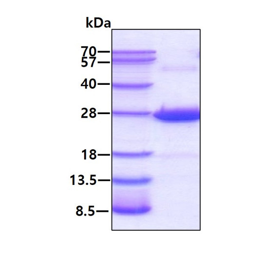 SDS-PAGE gel of recombinant human Crystallin beta A4 CRYBA4 protein 3µg reducing conditions Coomassie stain