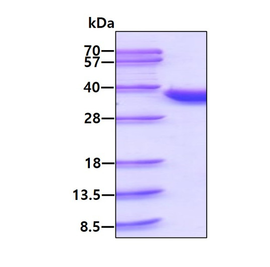 SDS-PAGE gel of recombinant human CDK2 protein stained with Coomassie blue