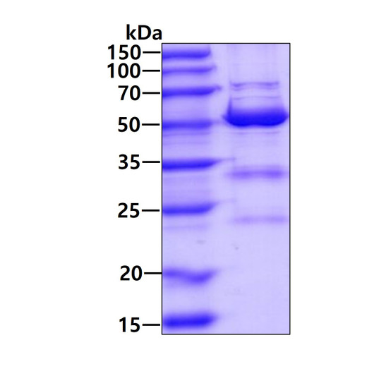 SDS-PAGE gel of recombinant human KAT2A GCN5 protein under reducing conditions stained with Coomassie blue