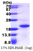 SDS-PAGE gel of recombinant human CRCP protein 3µg under reducing conditions with Coomassie blue stain