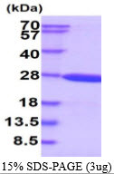 SDS-PAGE gel of recombinant human Crystallin gamma S CRYGS protein under reducing conditions