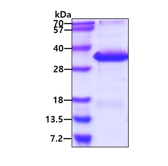 SDS-PAGE gel of recombinant human LAT protein 3 µg under reducing conditions Coomassie blue stain