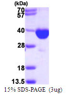 SDS-PAGE gel of recombinant human PECR protein 3µg reducing conditions Coomassie blue stain