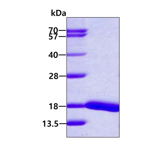 SDS-PAGE gel showing recombinant human UbcH5d UBE2D4 protein 3μg under reducing conditions Coomassie blue stain