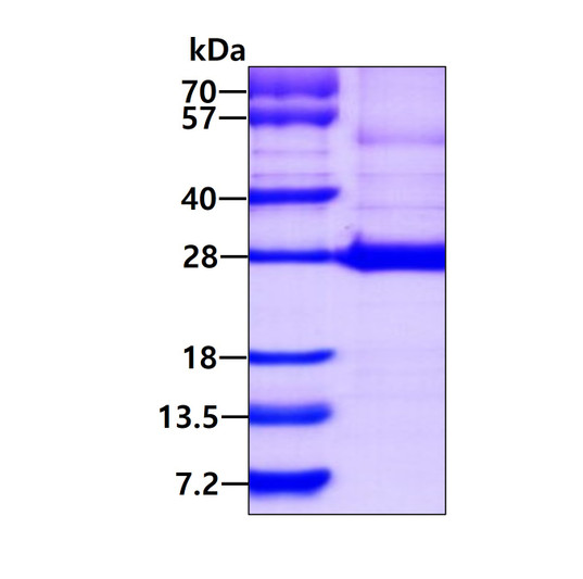 SDS-PAGE gel of recombinant human ARFRP2 ARL15 protein under reducing conditions