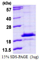 SDS-PAGE gel of recombinant human HDDC3 protein under reducing conditions stained with Coomassie blue