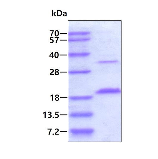 SDS-PAGE gel of recombinant human UbcH5c UBE2D3 protein under reducing conditions stained with Coomassie blue
