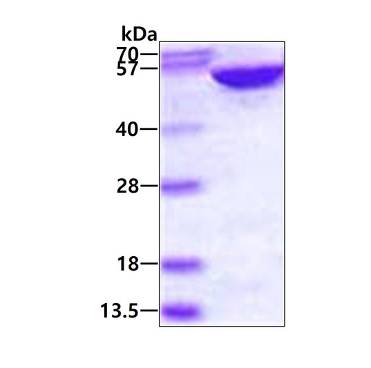 SDS-PAGE gel of recombinant human ADSL protein 3µg reducing conditions Coomassie blue stain