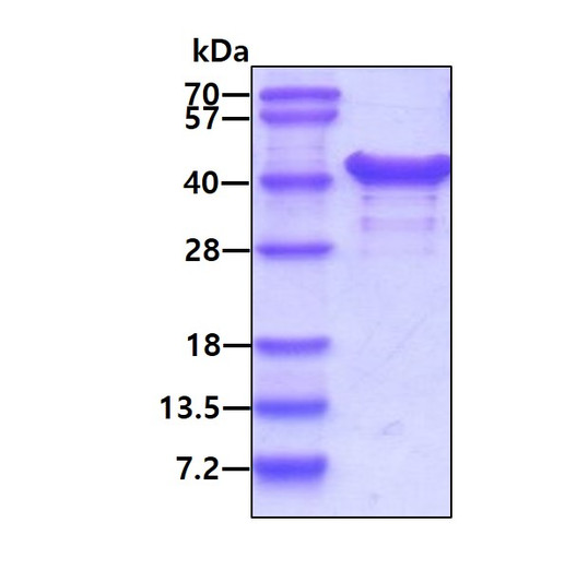 SDS-PAGE of recombinant human NACA protein under reducing conditions stained with Coomassie blue