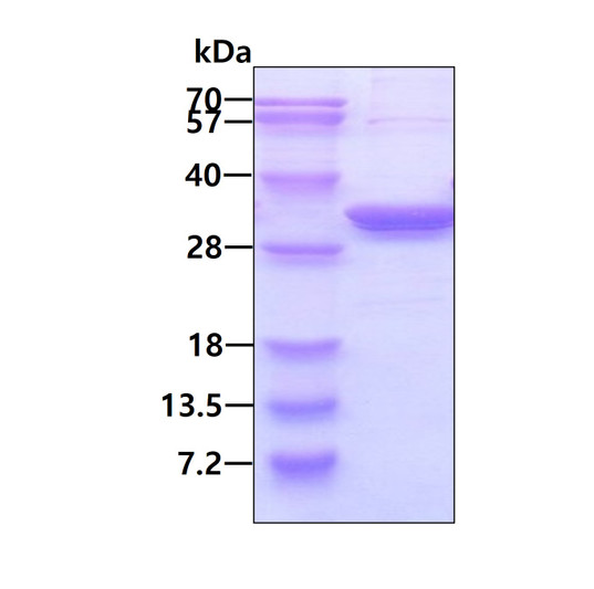 SDS-PAGE gel of recombinant human PA28 beta PSME2 protein under reducing conditions