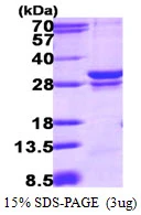 SDS-PAGE gel of recombinant human RAB23 protein under reducing conditions stained with Coomassie blue