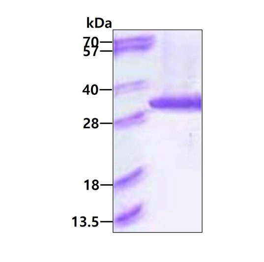SDS-PAGE gel of recombinant human PSMA6 protein 3 μg under reducing conditions Coomassie blue stain