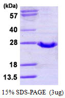 SDS-PAGE of recombinant human GPX2 protein STJP017449 under reducing conditions