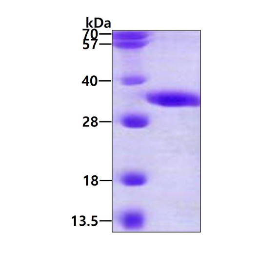 SDS-PAGE gel of recombinant human DECR2 protein 3µg under reducing conditions Coomassie blue stain