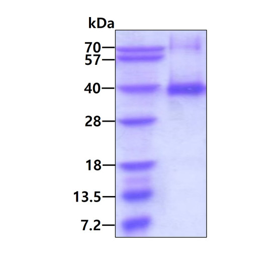 SDS-PAGE gel of recombinant human CCNG1 protein 3μg under reducing conditions Coomassie blue stain