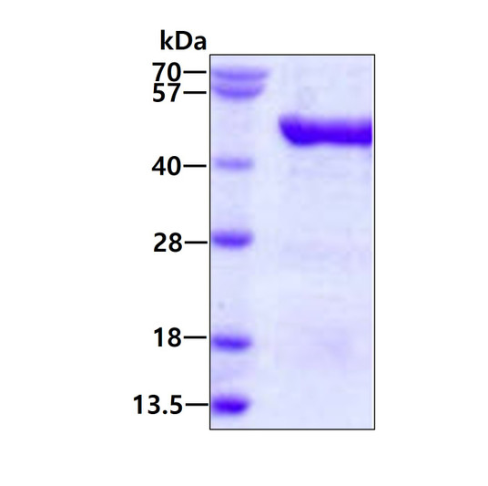 SDS-PAGE gel of recombinant human VAT1 protein 3μg under reducing conditions Coomassie blue stain