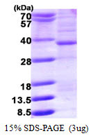 SDS-PAGE gel of recombinant human HMGCL protein under reducing conditions stained with Coomassie blue