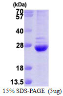 SDS-PAGE of recombinant human PSMB6 protein under reducing conditions with Coomassie blue stain