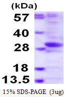SDS-PAGE gel of recombinant human PHOSPHO2 protein 3µg under reducing conditions Coomassie blue stain