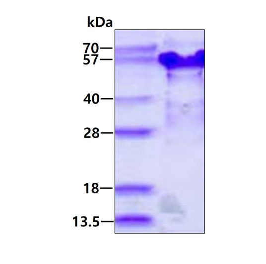 SDS-PAGE gel of recombinant human TSSC4 protein 3µg reducing conditions Coomassie blue stain