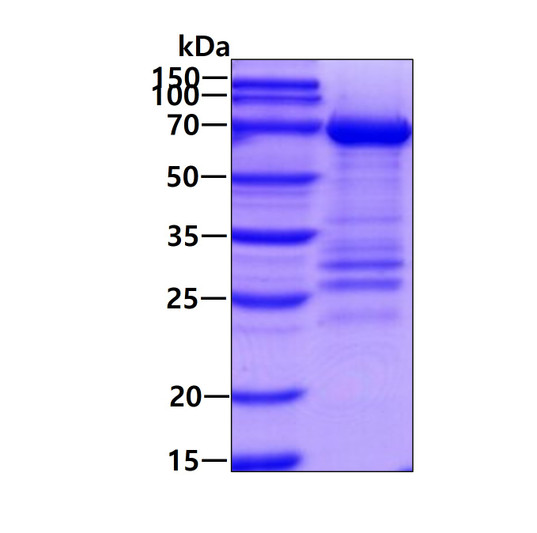 SDS-PAGE gel of recombinant human PCK1 protein 3µg under reducing conditions Coomassie blue stain