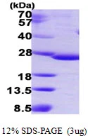 SDS-PAGE gel of recombinant human IDNK gluconokinase protein under reducing conditions