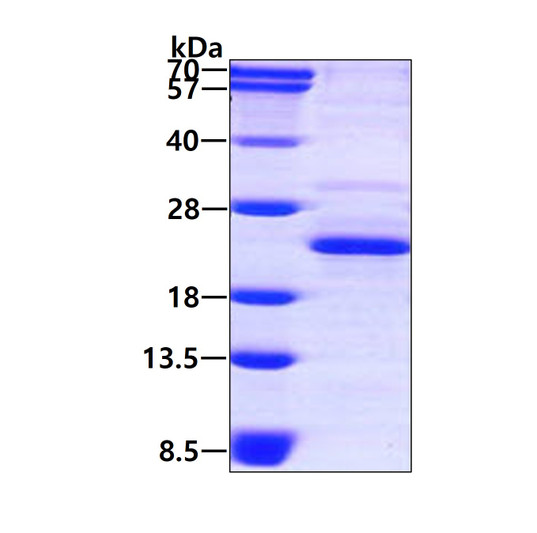 SDS-PAGE of recombinant human DCTPP1 protein under reducing conditions stained with Coomassie blue