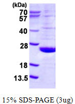 SDS-PAGE gel of recombinant human DUSP21 protein under reducing conditions stained with Coomassie blue