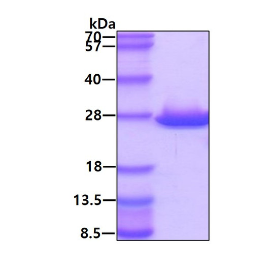 SDS-PAGE gel of recombinant human ABHD14B protein under reducing conditions Coomassie blue stain
