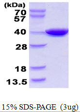 SDS-PAGE gel of recombinant E. coli coaA protein 3 µg under reducing conditions