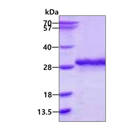 SDS-PAGE gel of recombinant human SSU72 protein 3µg stained with Coomassie blue
