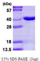 SDS-PAGE gel of recombinant human PIR-B protein under reducing conditions stained with Coomassie blue