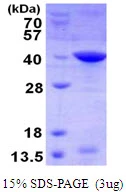 SDS-PAGE gel of recombinant human Livin beta protein under reducing conditions stained with Coomassie blue