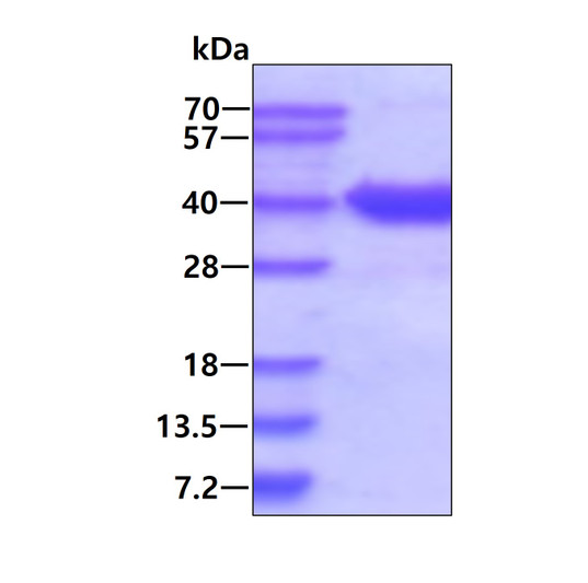 SDS-PAGE gel of recombinant human ASPA protein under reducing conditions Coomassie blue stain