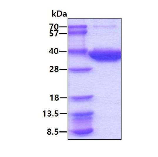 SDS-PAGE of recombinant human ECHDC1 protein under reducing conditions stained with Coomassie blue