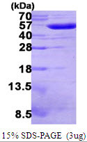 SDS-PAGE gel of recombinant E. coli Gor protein under reducing conditions stained with Coomassie blue