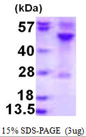 SDS-PAGE gel of recombinant human RRAGC protein under reducing conditions stained with Coomassie blue