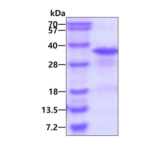 SDS-PAGE gel showing recombinant human RPL8 protein 3µg under reducing conditions Coomassie blue stain