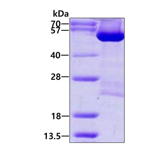 SDS-PAGE of recombinant human DARS protein under reducing conditions Coomassie blue stain