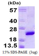 SDS-PAGE gel of recombinant mouse VPS29 protein stained with Coomassie blue