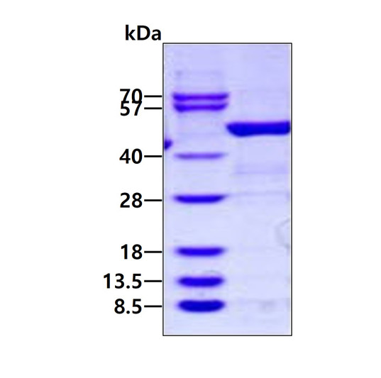 SDS-PAGE gel of recombinant human ARHGDIB protein under reducing conditions stained with Coomassie blue
