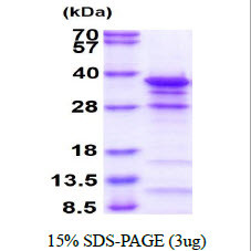 SDS-PAGE gel of recombinant human EYA2 protein under reducing conditions stained with Coomassie blue