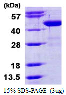 SDS-PAGE of recombinant human BCAT1 protein under reducing conditions with Coomassie blue stain